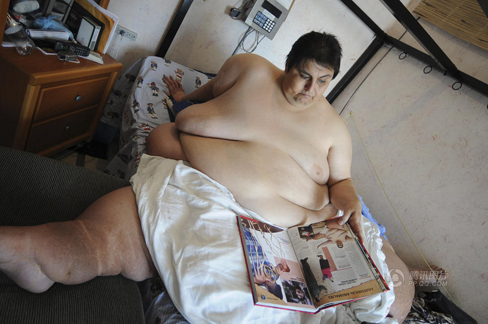 Fallece el mexicano considerado más gordo del mundo