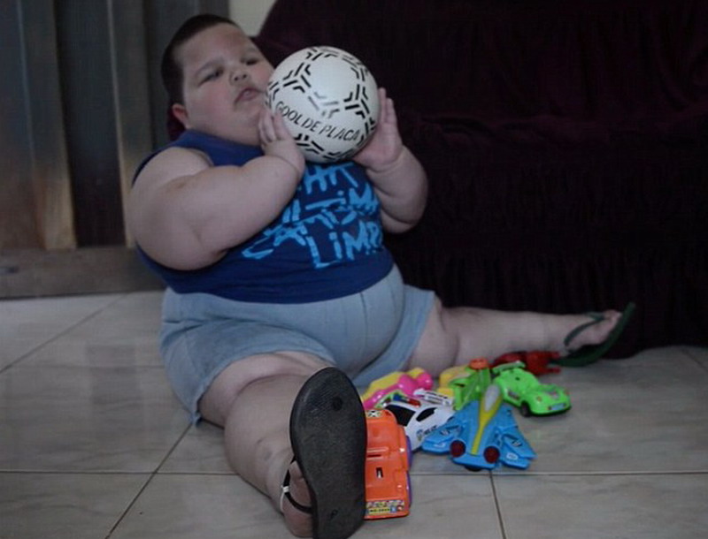 Un niño brasileño de 3 años pesa 70 kilos 