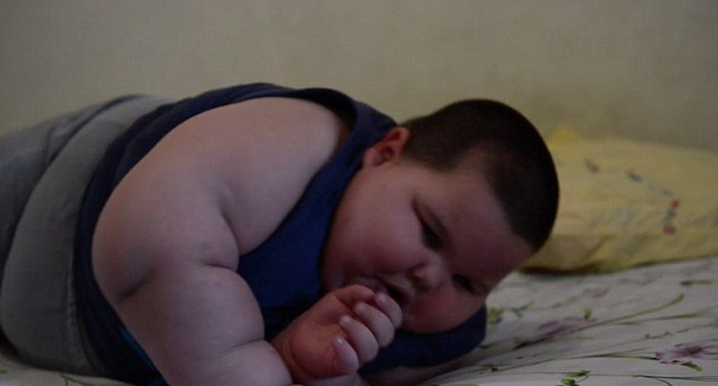 Un niño brasileño de 3 años pesa 70 kilos  4