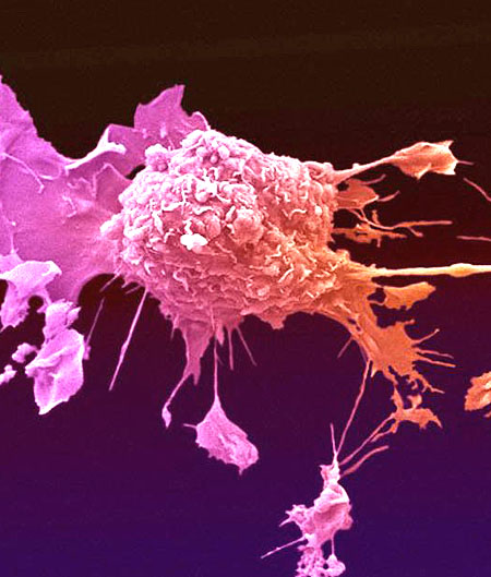 Científicos chinos descubren virus que destruye células cancerosas