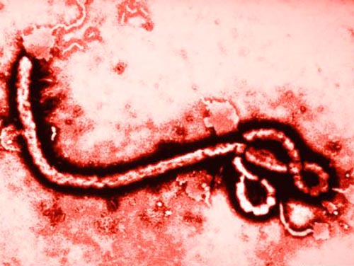Paciente da positivo por ébola en Nueva York