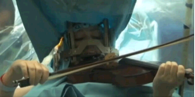 Mientras le operan el cerebro, ofrece un concierto con su violín