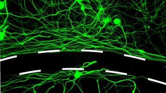 Nuevo fármaco regenera el crecimiento nervioso tras lesión medular