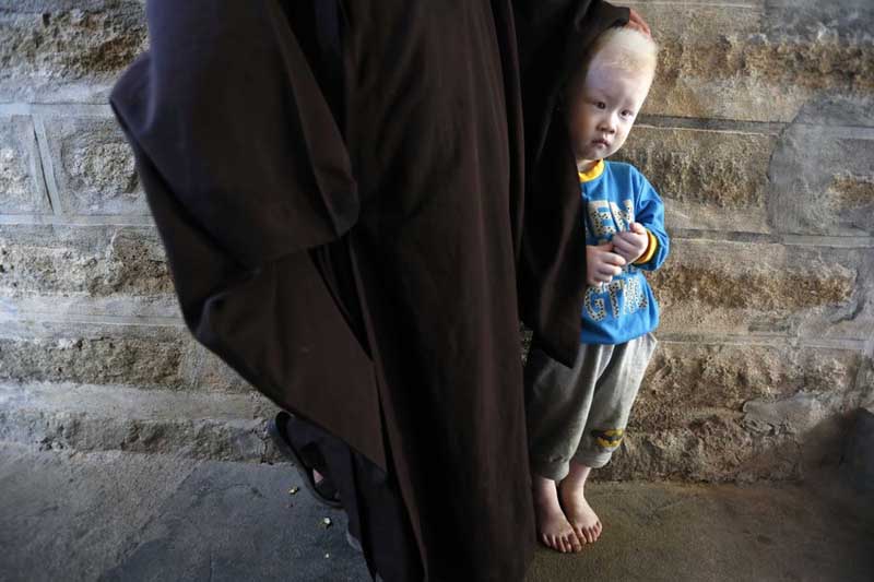 Un niño adoptado albino se esconde bajo la sotana de una monja, el 27 de agosto, 2014.