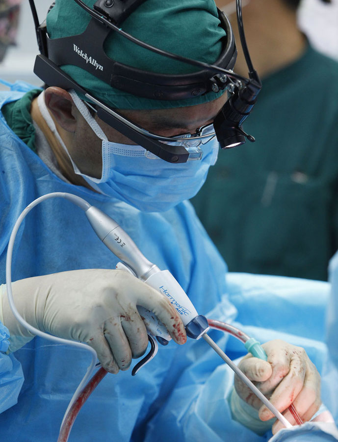 Hospital chino utiliza las Google Glass durante una operación