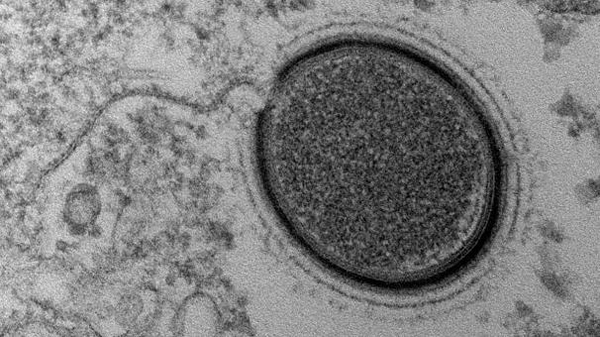 Descubren un nuevo virus gigante de más de 30.000 años en Siberia