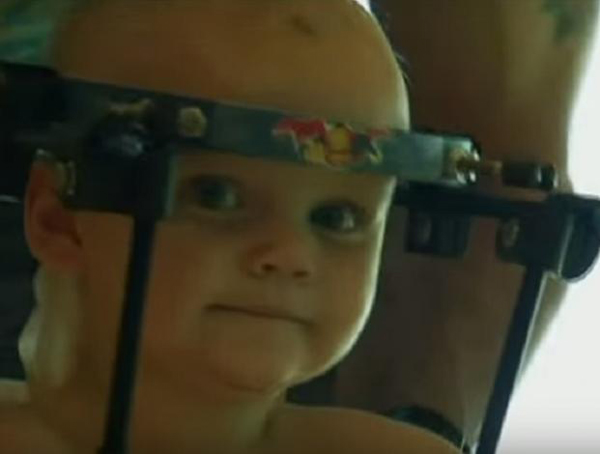 Reimplantan la cabeza a un bebé después de ser «decapitado»
