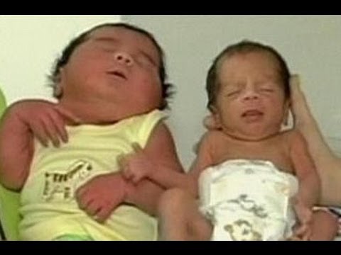 Nace en Colombia un bebé gigante