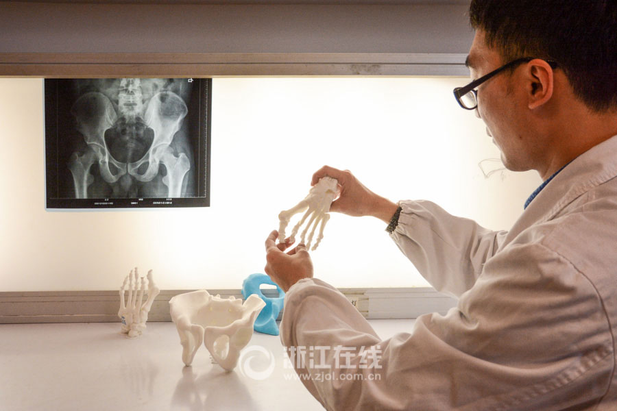 Trabajadores del Primer Hospital del Pueblo del distrito Xiaoshan utilizan con éxito la tecnología de impresión 3D para realizar una cirugía ortopédica en Hangzhou, capital de la provincia oriental de Zhejiang. (Foto/Zjol.com.cn)