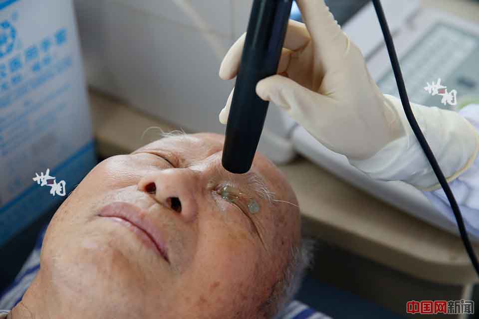 Un doctor comprueba los ojos de un paciente. (Foto / news.china.com.cn)