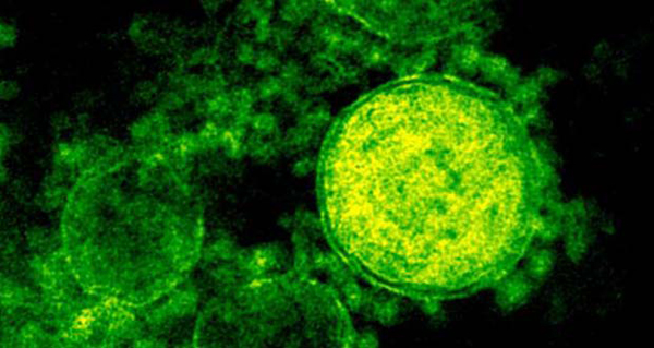Los científicos alertan sobre un nuevo virus mortal que amenaza al mundo