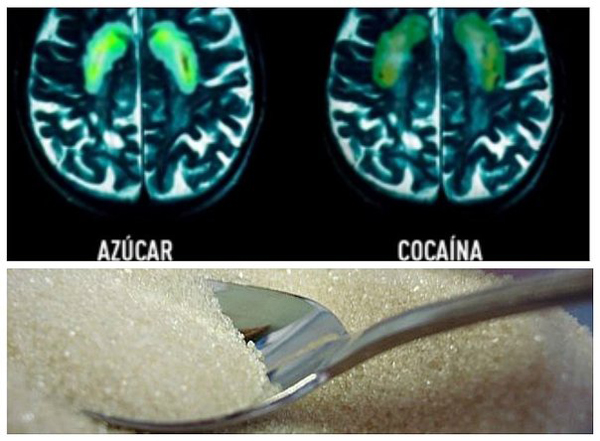 El azúcar puede provocar los mismos efectos que la cocaína