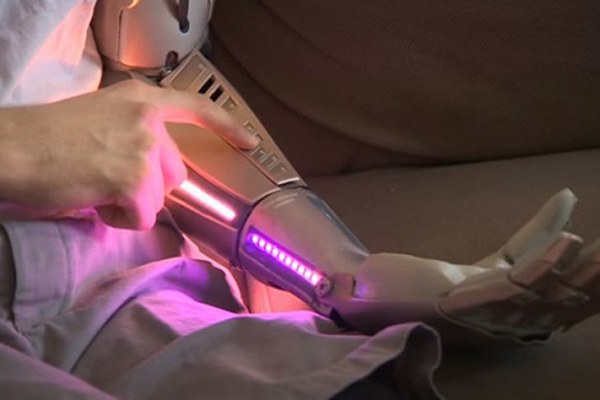 Un discapacitado británico utiliza un brazo biónico con luz láser, puerto USB y un dron