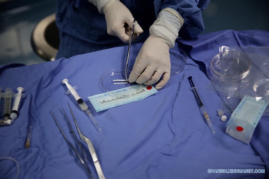 Un doctor realiza una operación para un paciente con lesión de la médula espinal en el hospital afiliado de la Universidad de Logística de la Fuerza de la Policía Armada del Pueblo, en Tianjin, en el norte de China, el 16 de junio de 2016. Los científicos chinos han utilizado un biomaterial "andamios" para tratar lesiones de la médula espinal, anunció el jueves la Academia China de Ciencias (CAS, por sus siglas en inglés). Un equipo dirigido por Dai Jianwu, investigador del Instituto de Genética y Biología del Desarrollo de la CAS, propuso por primera vez la creación de un microambiente con biomaterial que ayudaría a la regeneración de neuronas, dijo el CAS. (Xinhua/Jin Liwang)