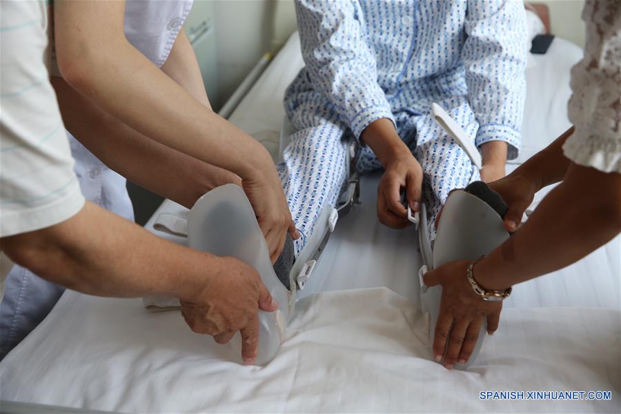 El primer paciente en ser implantado con andamios a base de colágeno realiza ejercicios de rehabilitación en el hospital afiliado de la Universidad de Logística de la Fuerza de la Policía Armada del Pueblo, en Tianjin, en el norte de China, el 16 de junio de 2016. Los científicos chinos han utilizado un biomaterial "andamios" para tratar lesiones de la médula espinal, anunció el jueves la Academia China de Ciencias (CAS, por sus siglas en inglés). Un equipo dirigido por Dai Jianwu, investigador del Instituto de Genética y Biología del Desarrollo de la CAS, propuso por primera vez la creación de un microambiente con biomaterial que ayudaría a la regeneración de neuronas, dijo el CAS. (Xinhua/Jin Liwang)