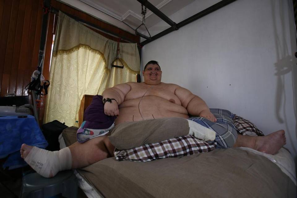 El hombre más obeso del mundo será intervenido tras perder casi 30 por ciento de su peso