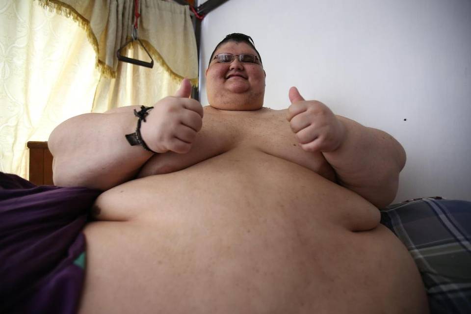 El hombre más obeso del mundo será intervenido tras perder casi 30 por ciento de su peso