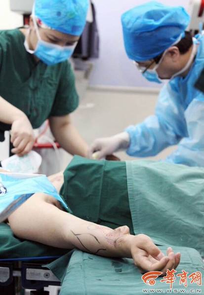 Cirujanos chinos trasplantan oreja regenerada de brazo a cabeza