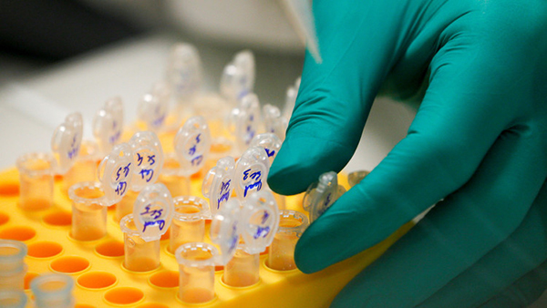 Logran primera vez frenar el VIH en ratones “humanizados”