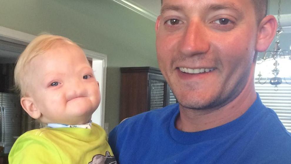Muere Eli Thompson, el ‘bebé milagro’ que nació sin nariz