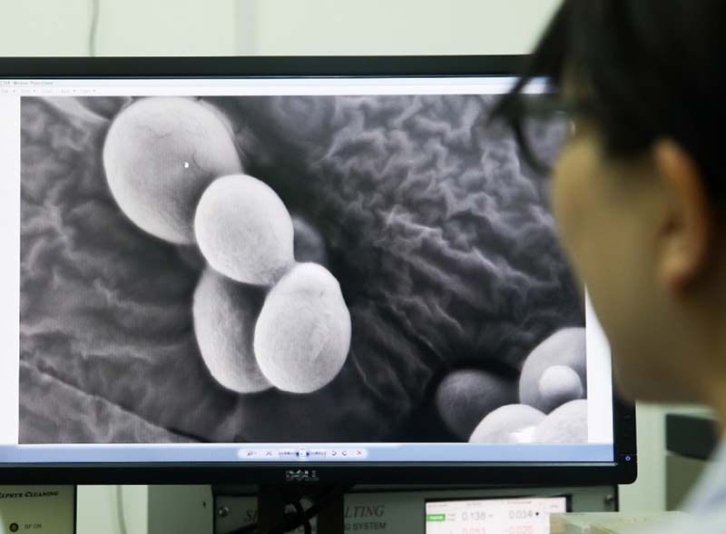 Científicos de la Academia China de Ciencias creó la levadura de un solo cromosoma del mundo, lo que constituye un gran avance en el estudio de la "vida artificial" de los organismos. En agosto de 2018, los resultados se publicaron en la conocida revista Nature. Por Ding Ting, Agencia de Noticias Xinhua.