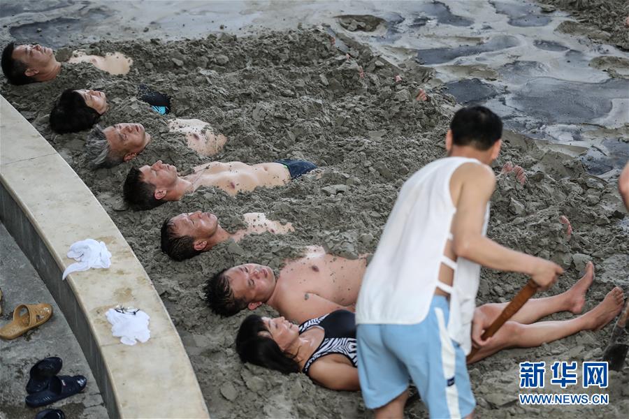 El 4 de junio, un paciente ruso (cuarto desde la izquierda) fue tratado con terapia de lodo mineral caliente con pacientes chinos. (Foto: Pan Yulong / Xinhua)