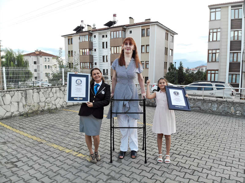Una mujer turca de 24 años es la mujer viva más alta del mundo