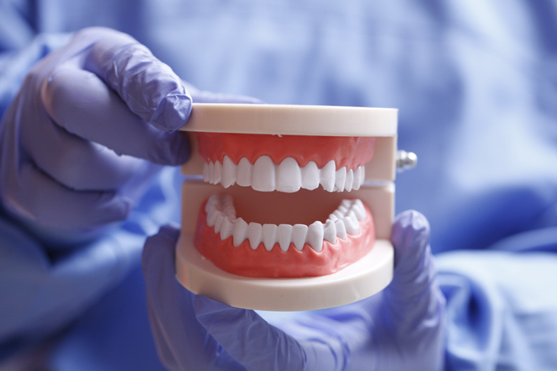 Las autoridades actúan ante el precio desigual de los implantes dentales 