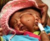 Niña con dos caras, dos bocas y cuatros ojos nacida en la India