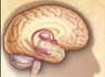 Los investigadores hallan una clave en las causas del Alzheimer