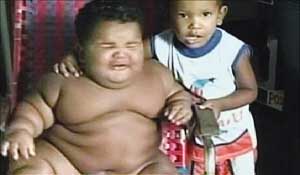 Niño obeso colombiano pesa 28 kilogramos a 11 meses de edad