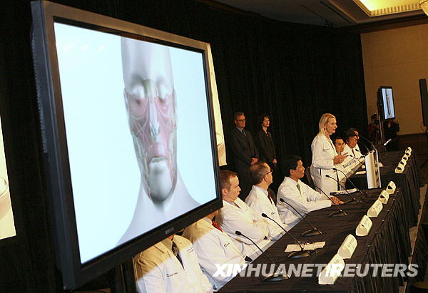 El mayor transplante de cara se realiza con éxito en EEUU