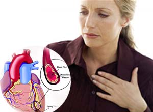 Un alto ritmo cardiaco en reposo aumento el riesgo de ataque al corazón en las mujeres, según un estudio