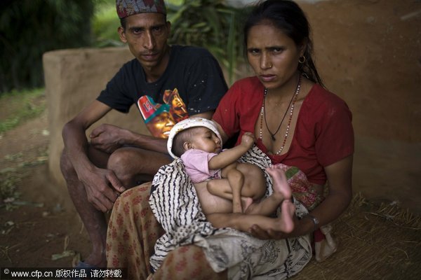 Niño Nepalés Con 4 Manos Y 4 Piernas Es Considerado Como Reencarnación De Divinidad 7825