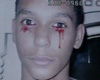 Aparece en EEUU “adolescente de lágrimas de sangre”
