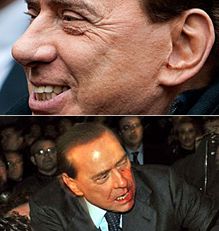 PM italiano regresa a oficina después de ataque y promete reformas 