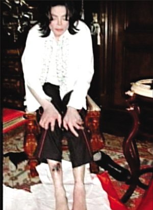 Foto De Autopsia De Michael Jackson Valorada En Cinco Millones De D Lares