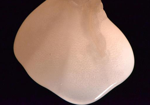 Crean el primer riñón de laboratorio que produce orina